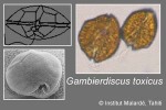 Enlarged Image of 'Gambierdiscus toxicus'